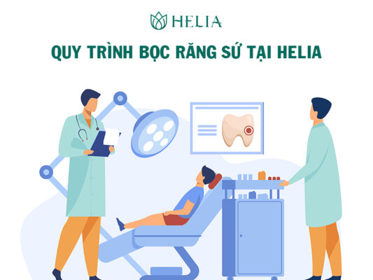 Quy trình 6 bước bọc răng sứ