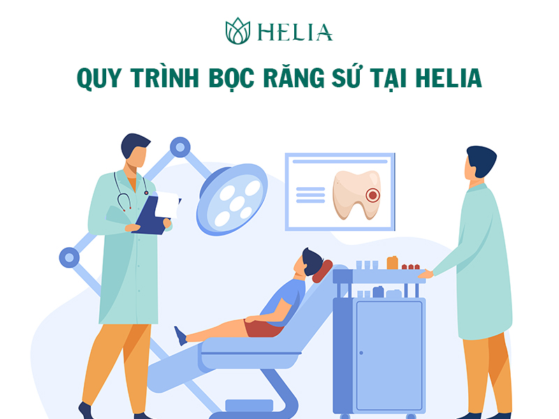 Quy trình 6 bước bọc răng sứ